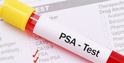 FREE PSA 