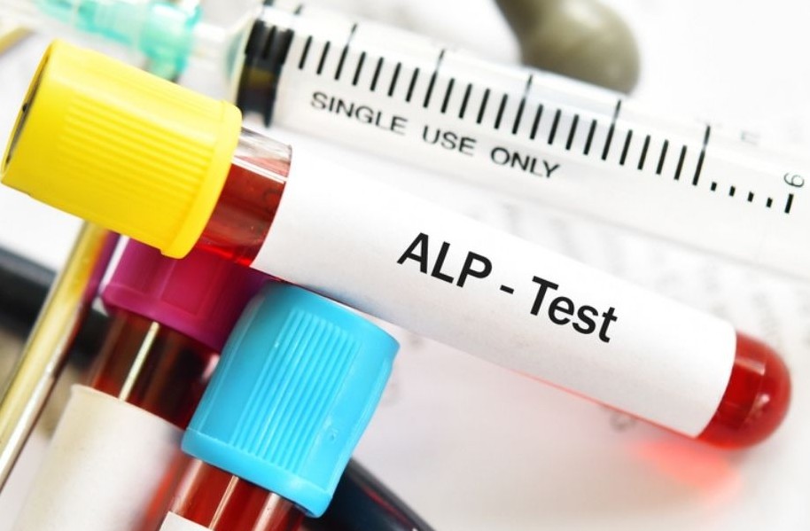 ALKALINE PHOSPHATASE (ALP)