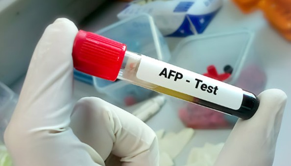 ALPHA FETO PROTEIN