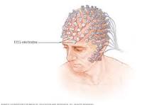 EEG 