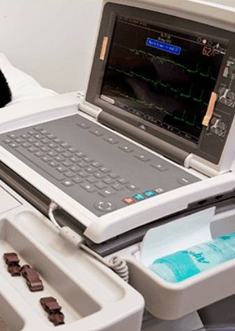 Echocardiography 2D