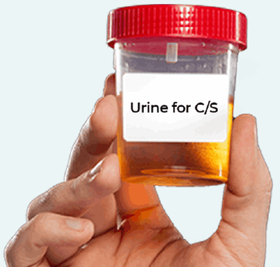 URINE C/S