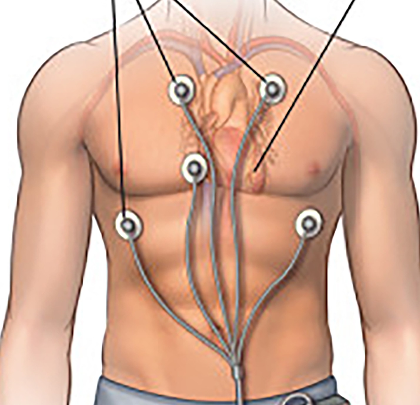 ELECTROCARDIOGRAPHY(ECG) 